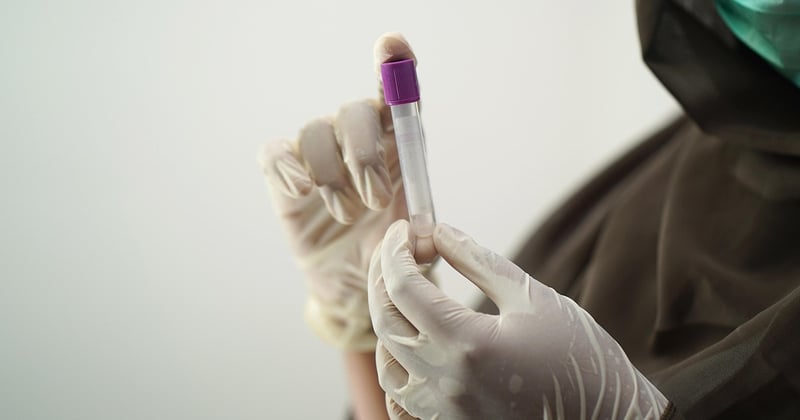 La drépanocytose bientôt vaincue ? L’essor des thérapies géniques qui change tout